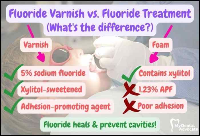 Fluoride varnish post op instructions